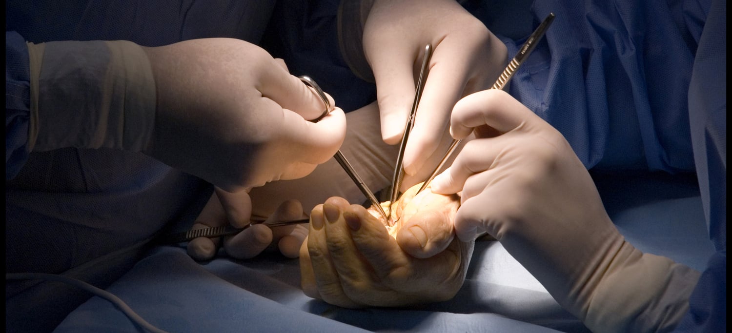 Surgeons performing carpal tunnel surgery