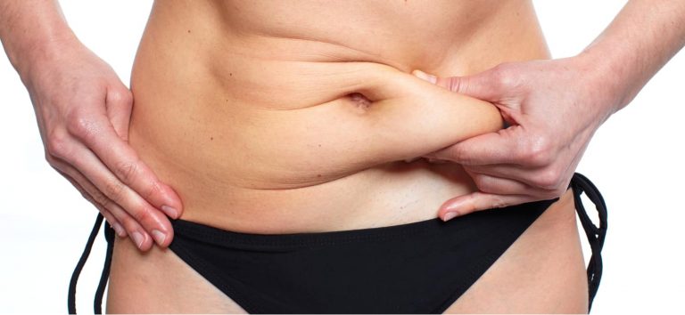 a woman with loose skin on her stomach that could benefit from body contouring surgery