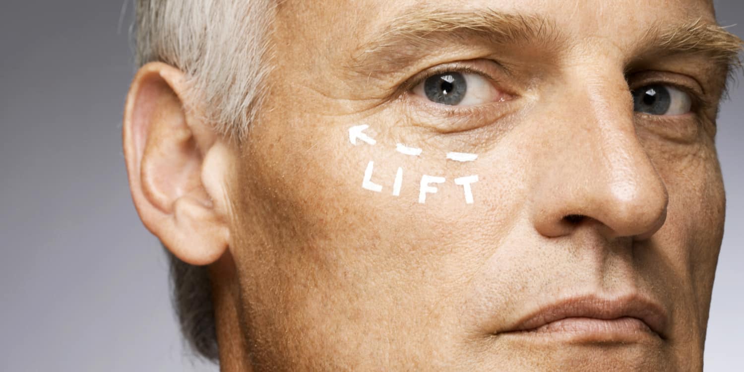 An older man with "lift" written on his face in preparation for blepharoplasty, a common plastic surgery for men
