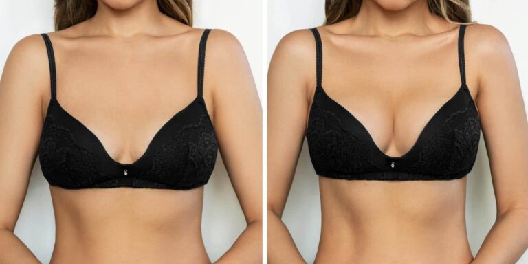 woman showing result of breast augmentation surgery from the hess sandeen & lee