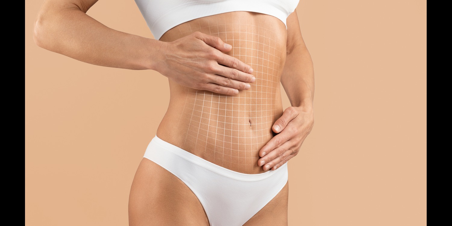 woman showing off her tummy tuck after getting surgery from hess sandeen & lee